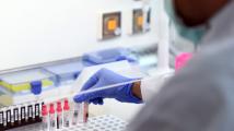 بريطانيا تجري أكبر تجربة في العالم لعلاج فيروس كورونا