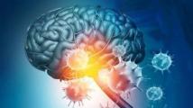 دراسة تكشف: إصابة كورونا الحاد تشبه تأثير شيخوخة دماغ الإنسان