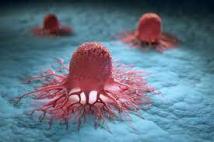 فحص ثوري يكشف 4 سرطانات تصيب النساء دفعة واحدة